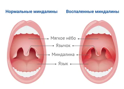 Добрый вечер Я сегодня был на практике в педиатрии и одна мамочка скинула  мне горла ребёнка а я не - Школьные Знания.com