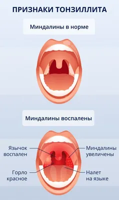 9 эффективных спреев для горла детям 2024: рейтинг недорогих средств для  детей разного возраста по версии КП с ценами и отзывами