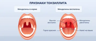 Красные пятна на языке: причины и лечение