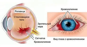 Кровь в глазу или гифема у кошек и собак: причины, симптомы, лечение