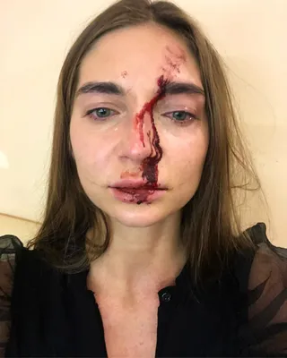 Девушке разбили в кровь лицо и отобрали телефон во время похода в салон  красоты | WOMAN