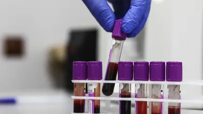 В Британии сделали переливание выращенной в лаборатории крови человеку -  РИА Новости, 