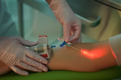 Восстановительная медицина - Внутривенное лазерное облучение крови