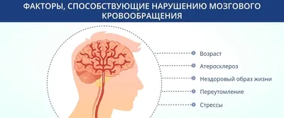 Нарушение кровообращения мозга - симптомы, лечение, причины, признаки,  последствия, виды, стадии, диагностика