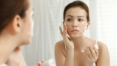 Купероз: причины, симптомы, способы лечения: что такое купероз сосудов кожи  лица