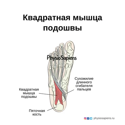 Чугунная квадратная сковорода гриль Perfelli 5660 25x25 см.