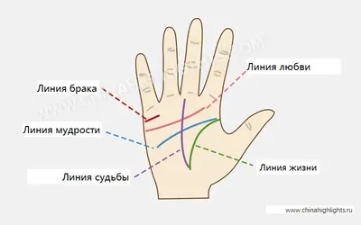 Что делать если немеет кисть левой руки? - Доктор Позвонков