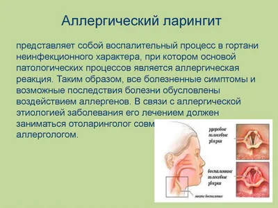 Хрипота, сухой кашель и зуд в горле: чем опасен ларингит и как с ним  побыстрее справиться | Все о бактериофагах | Дзен