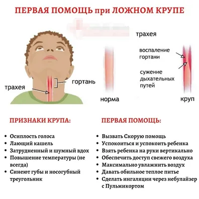 Лечение ларингита у детей и взрослых - симптомы, диагностика, профилактика