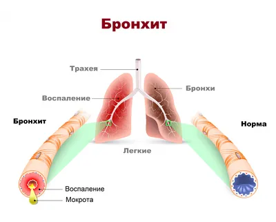 Лёгкие человека изнутри, бронхи, …» — создано в Шедевруме