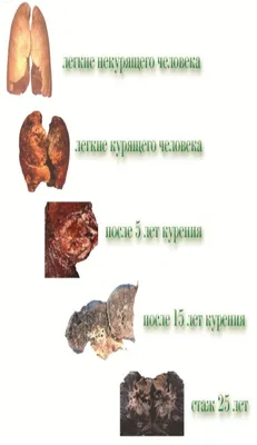 Лёгкие человека рисунки - 115 фото