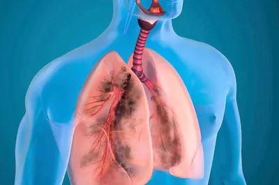 15 фактов о лёгких человека | StuDentistry | Дзен