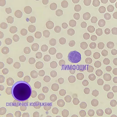 Клетки крови: лейкоциты, эритроциты, тромбоциты — Мария Семочкина на  