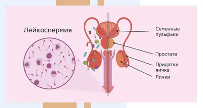 Лейкоциты в анализе крови (WBС): как расшифровать анализ? | Клиника Эксперт