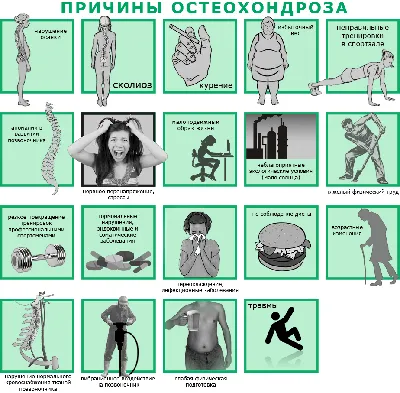 Гимнастика при остеохондрозе грудного отдела - комплекс упражнений