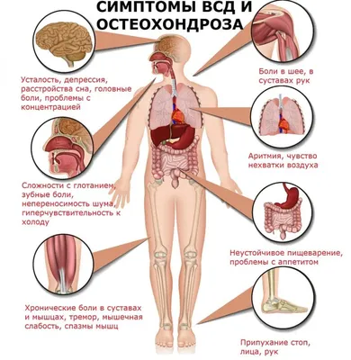 Остеохондроз: истории из жизни, советы, новости, юмор и картинки — Все  посты, страница 2 | Пикабу