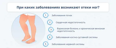 Лимфедема бедра после операции и лучевой терапии | Отзыв Ирины