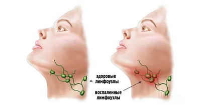 3.9. Опухолевые поражения периферических и внутригрудных лимфоузлов