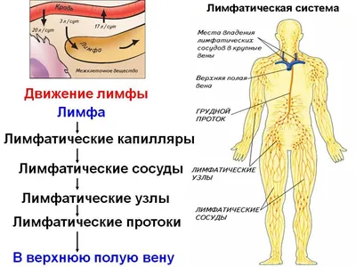 Понятие Болезни Лимфедемы Опухание Женских Ног Рук Поврежденные Лимфоузлы  Теле Векторное изображение ©Pikovit 574273370