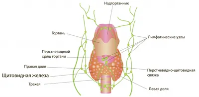 Рак щитовидной железы - симптомы, признаки.