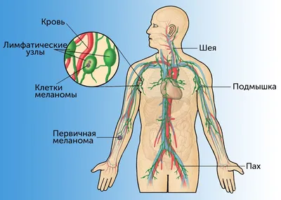 Причины увеличения лимфоузлов | Международная клиника MEDICA24 | Дзен