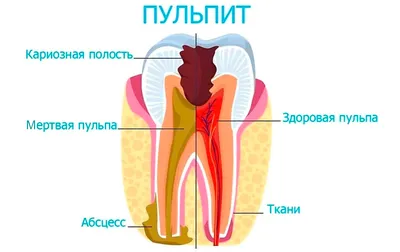 Варикоз на ногах, как избавиться? | Блог Daily Medical