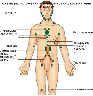 Лимфатические узлы и виды онкологических заболеваний