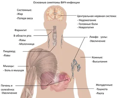 Симптомы, признаки и лечение ВИЧ-инфекции у женщин и мужчин — Медюнион