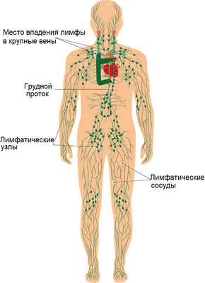 Неходжкинская лимфома: симптомы, признаки, лечение, прогноз