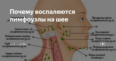 Лимфаденит: симптомы, причины, классификация, что делать при воспалении  лимфоузлов