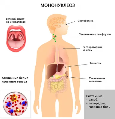 НЕМНОГО ПРО ЛИМФОУЗЛЫ! - Oncohelp