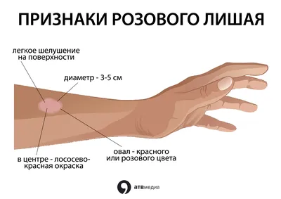 Эффективные препараты и мази для лечения лишая - Лекарства и схема лечения  от лишая