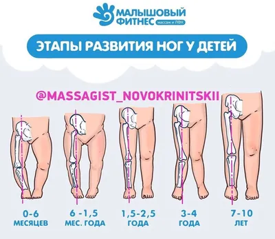 Если не делать массаж, ноги у ребенка будут кривыми | Игорь Новокриницкий |  Дзен