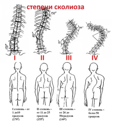 Лечебный массаж спины в СПб: цены на медицинский лечебный массаж в  приморском районе