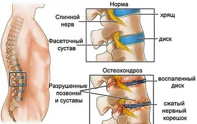 Массаж спины в Москве: цена от 1200 ₽, массаж позвоночника в клинике, отзывы