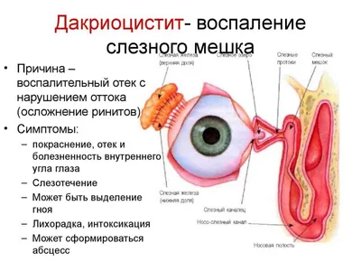 Закисает глаз у новорожденного: причины и решение | Nestle Baby