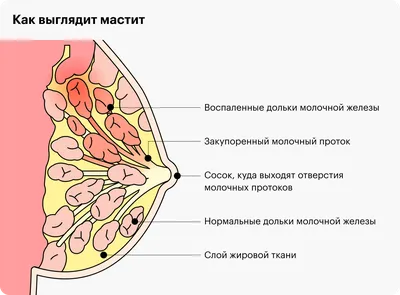 Зондирование носослезного канала при дакриоцистите или закупорке  носослезного канала - «Мамочки, а также те, кто только планирует  беременность, ВЫ ОБЯЗАНЫ ПРОЧЕСТЬ ЭТОТ ОТЗЫВ, ЧТО БЫ ЗНАТЬ, КАК СОХРАНИТЬ  ЗДОРОВЬЕ СВОЕМУ РЕБЕНКУ, на