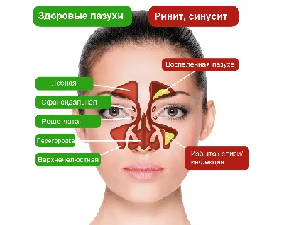 Как избавиться от ЗАЛОЖЕННОСТИ НОСА // Массаж от насморка, синусита и  гайморита. - YouTube