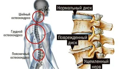 ᐈ Как Самому Сделать Массаж Шейно-Воротниковой Зоны