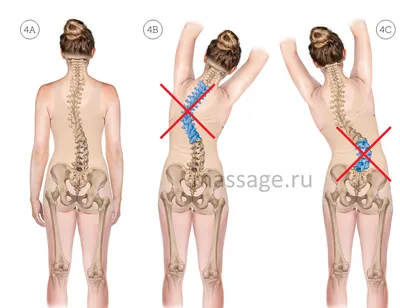 КУРСЫ МАССАЖА | АКАДЕМИЯ КИНЕЗИО | ОБУЧЕНИЕ МИНСК on Instagram: "МАССАЖ ПРИ  СКОЛИОЗЕ 💥 16-18 июля 💬Метод изучаемый на курсе включает в себя  предварительную диагностику типа сколиоза, тонуса мышц с обеих сторон