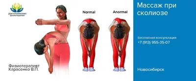 МАССАЖ ПРИ СКОЛИОЗЕ И ОСТЕОХОНДРОЗЕ - ДИСТАНЦИОННОЕ ОБУЧЕНИЕ -  Дистанционное обучение