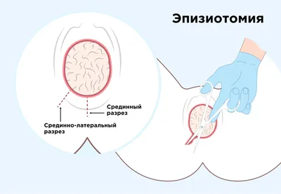 Массаж промежности перед родами картинки