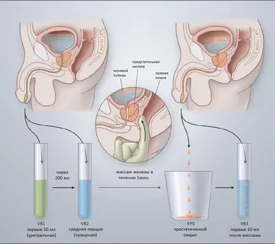 Самомассаж предстательной железы в домашних условиях - YouTube