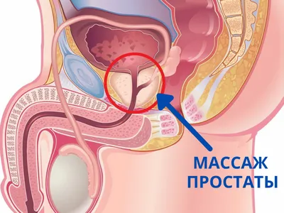 Что такое массаж простаты и стоит ли его делать - Лайфхакер