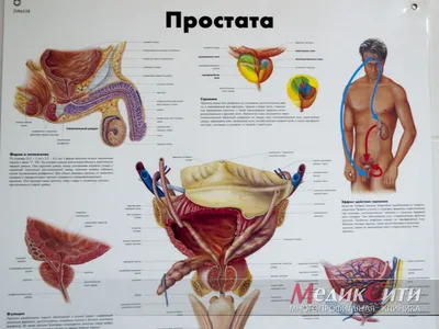 Аденома предстательной железы, лечение и симптомы. Удаление аденомы  предстательной железы.