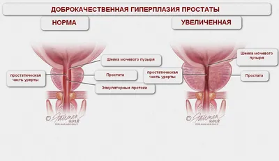 МАВИТ - физиотерапевтический аппарат для лечения простатита,  тепло-магнитно-вибромассажного действия. - Медицинская техника в Алматы -  Медицинское оборудование в Казахстане - Adamant Group