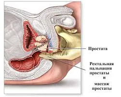 Аденома предстательной железы | Симптомы, осложнения, диагностика и лечение  | ВЦЭРМ им. А.М. Никифорова МЧС России в Санкт-Петербурге