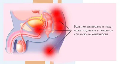 Массаж простаты - это приятно": "Руки-Базуки" позарился на славу Алексея  Панина - 