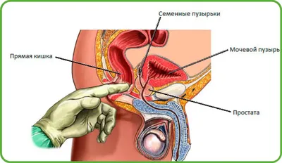 Массаж простаты в Москве: цены на лечебный массаж простаты в клинике  АльтраВита