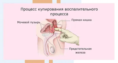 Как можно самому сделать массаж простаты: техники, правила, нюансы | Массаж,  Журнал о здоровье, Мужское здоровье